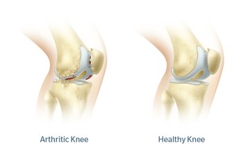 Knee diagram.jpg